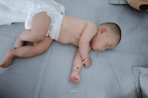 玉林宝宝褶皱处擦粉还是油